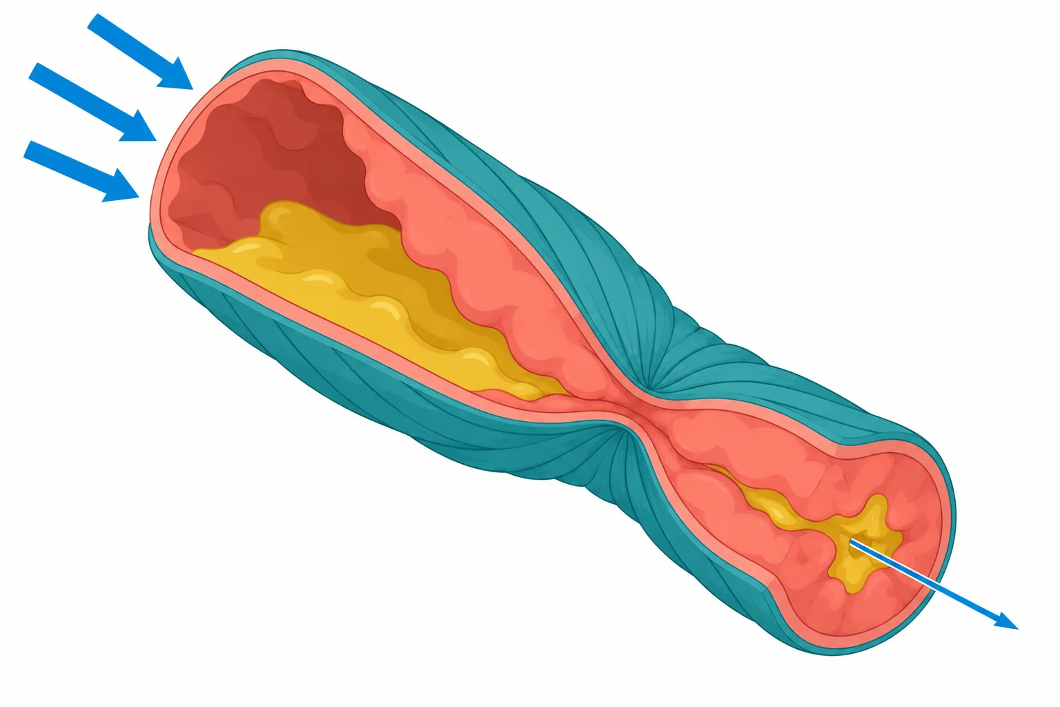 A cutaway airway shows muscle squeezing, swollen lining, and mucus narrowing the passage available for airflow.