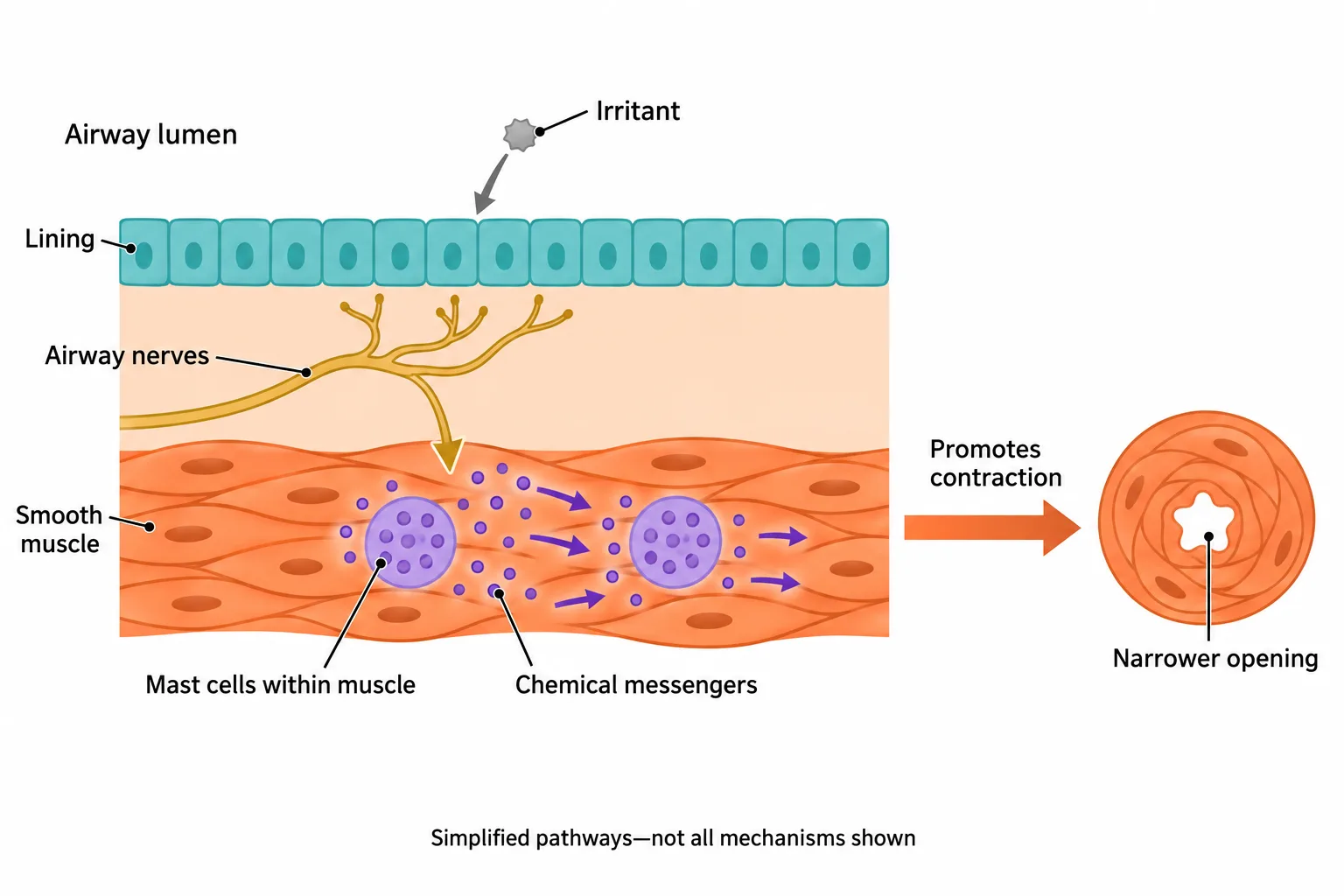 A simplified airway-wall diagram shows how irritant responses, nerves, and mast-cell messengers can promote muscle contraction.